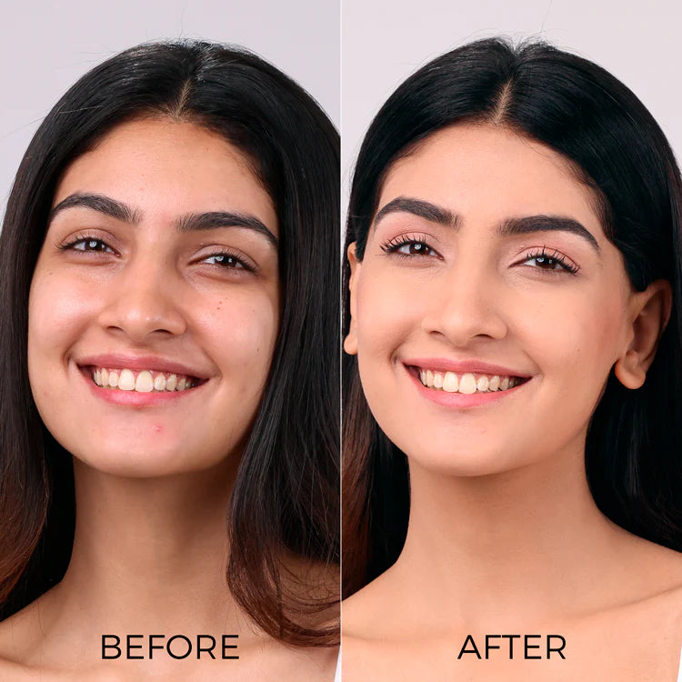 Before and After